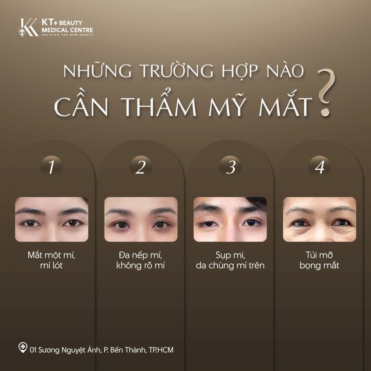 Thẩm mỹ vùng mắt: Khi nào cần can thiệp? Giải pháp phù hợp cho từng tình trạng